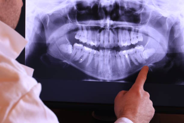 Best Walk-In Emergency Dental Services in Hermantown, MN